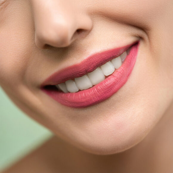 Blanqueamiento dental