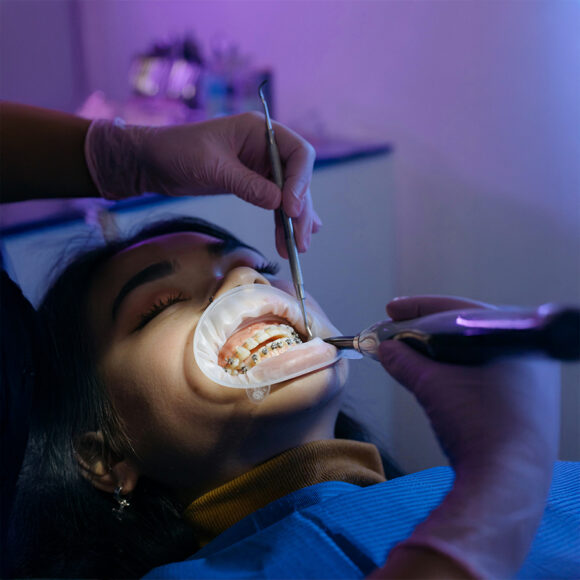 ¿Por qué la limpieza dental no es solo una cuestión estética?