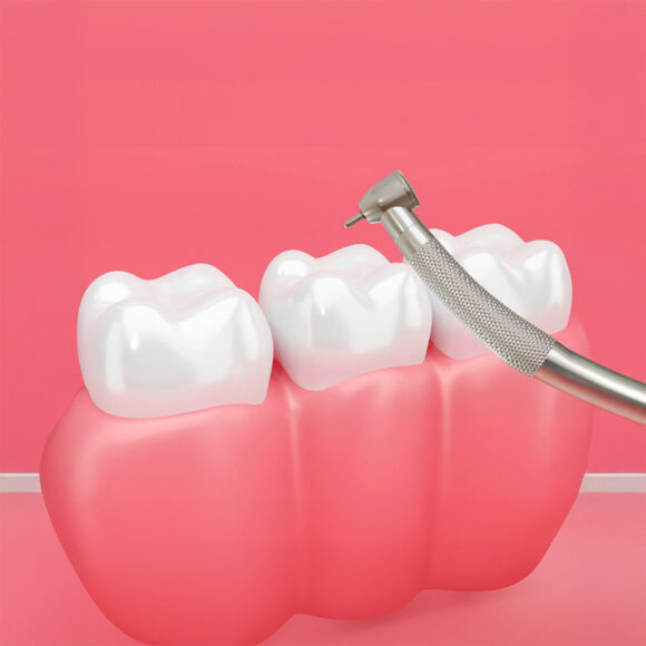 Periodoncia